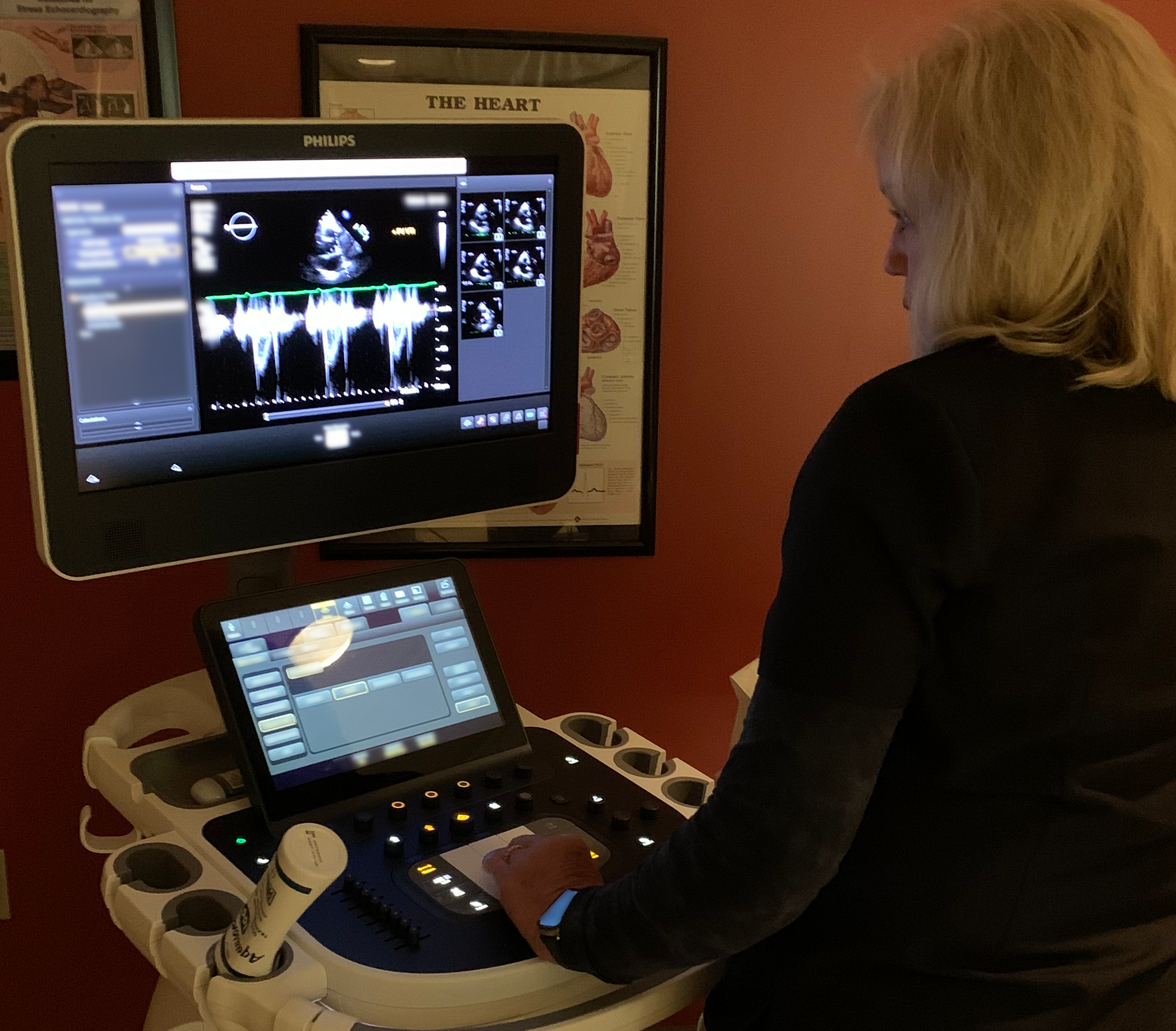 Cardiac Ultrasound Machine